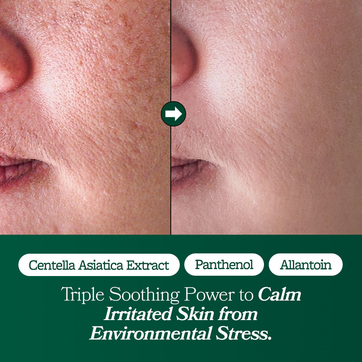 Omitted Fresh Lime Glow & Super Hydrating Moisturizer 80ml