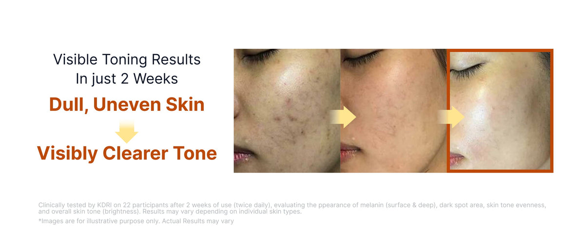 SUNGBOON EDITOR Kojic Acid Niacinamide Brightening Ampoule 35ml